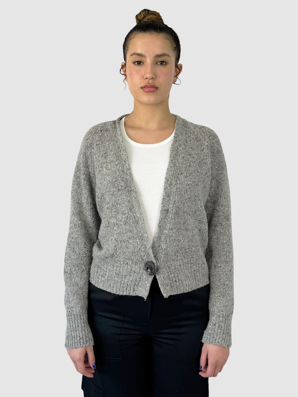 Detachable Fur Cardigan